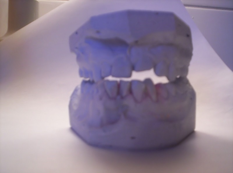 teeth