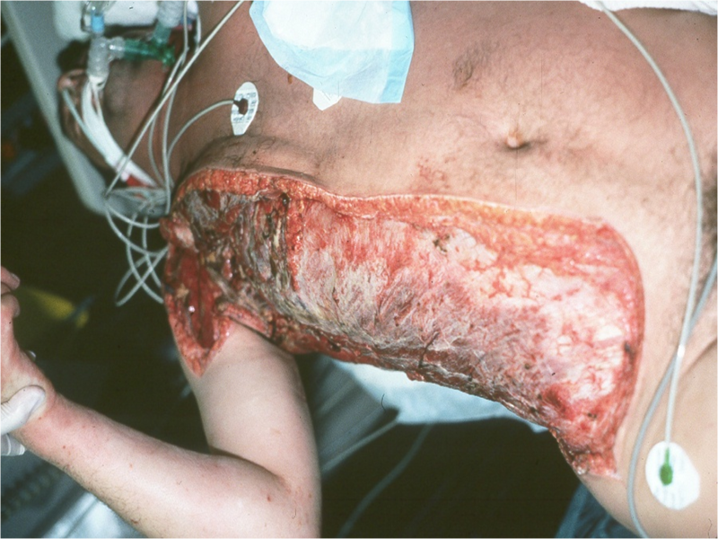 disease