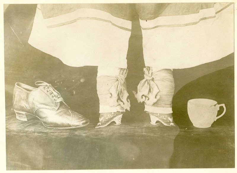 foot-binding