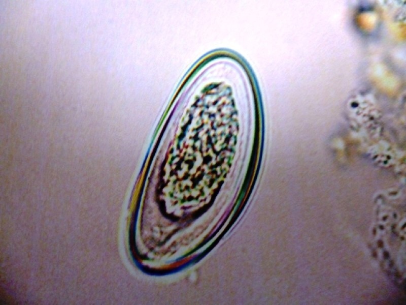 pinworm-eggs
