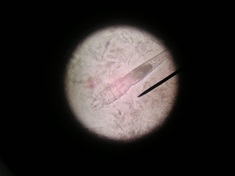 demodex-mite