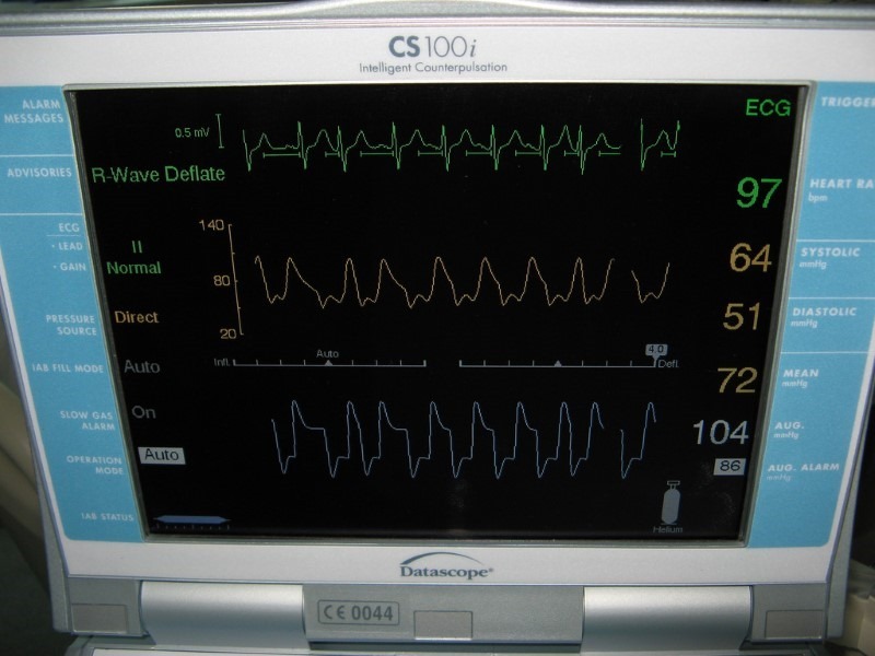 heart-monitor