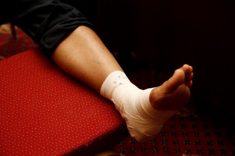 leg-injury