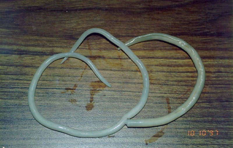 roundworm